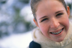 photo of girl with braces